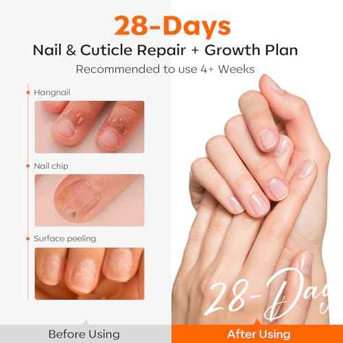 modelones Cuticle Oil Pen Rose for Growth and Strength Nail Growth Oil Cuticle Softener Quick Dry Nail Care Moisturize and Strengthen Damaged Nails 10ml 0.34Fl Oz