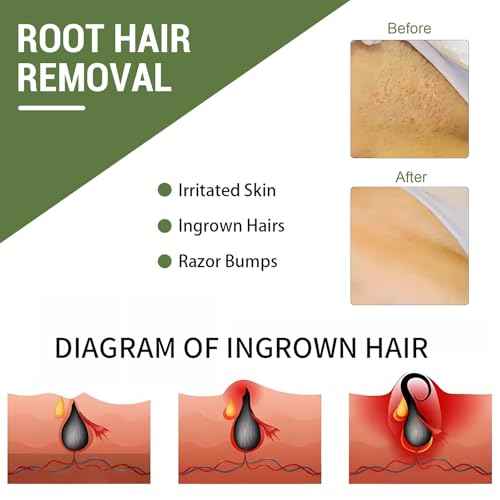 Ingrown Hair Treatment, Ingrown Hair Patch,Razor Bump Treatment for Bikini Area,30 Patches,Quickly and Effectively Clear Up Ingrown Hair Bumps Patch Smooth-Feeling,Non-Irritating Formula,Unisex