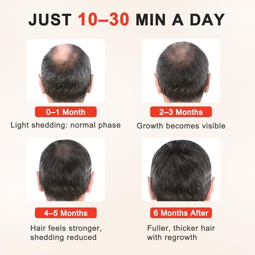 Red Light Hair Growth Cap with 528 LED Emitters