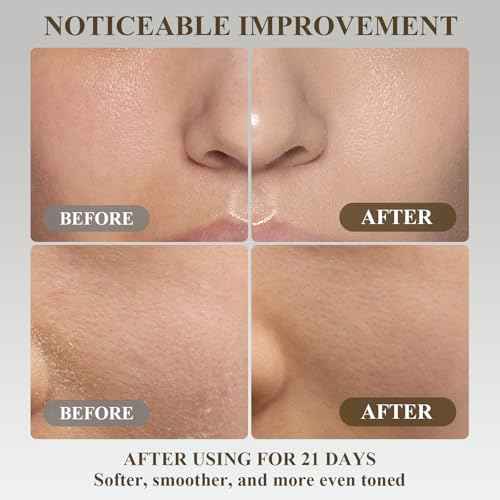 Beef Tallow for Skin, Whipped Tallow and Honey Balm Tallow Face Moisturizer, 100% Pure Beef Tallow Balm Blend of Vitamins Grass Fed Beef Tallow, All-Natural Moisturizer Hydrates and Nourishes the Skin