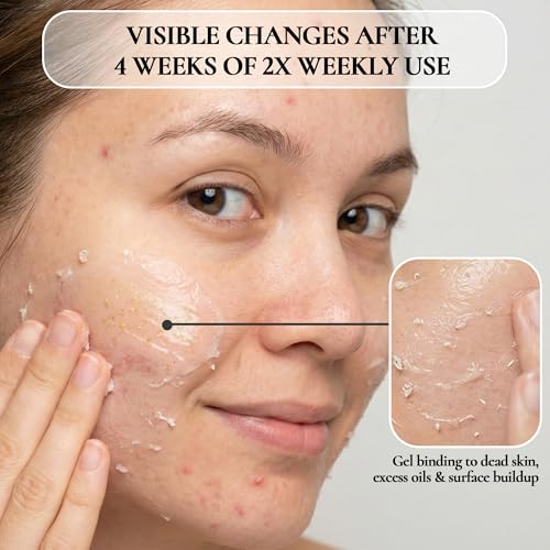 Vivo Per Lei Facial Peeling Gel - Helps Address Dead Skin Buildup - Gentle Exfoliating Gel for Rough, Dry, Sensitive or Mature Skin - Face and Body Scrub - Non Abrasive - 4.05 Fl. Oz. - Pack of 2