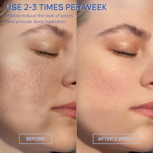 Bio-Collagen Real Deep Mask: Overnight Hydrating, Pore Minimizing, Glowing - Hydrogel With Hyaluronic Acid & Cica - Ultra Low Molecule - Women & Men - 5 Pcs