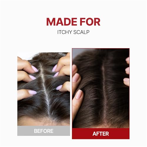 KUNDAL Root Enhancer Caffeine Scalp Tonic Herb Mint - 3.38 Fl Oz - B. Caffeine Scalp Treatment