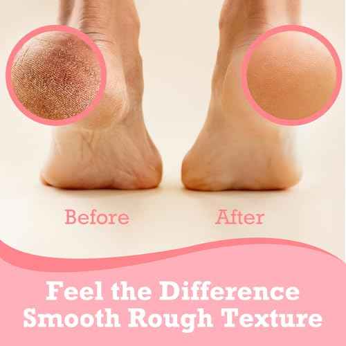 Foot Balm Stick Duo (2PC) | Hydrating & Moisturising Heel Balm | Softening and Nourishing Cream for Dry Heels, Hands & Elbows | Plant-Based Gentle Foot Cream (Pink & Blue)