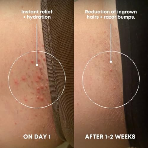 Bushbalm Ingrown Hair Exfoliating Scrub, 236ml