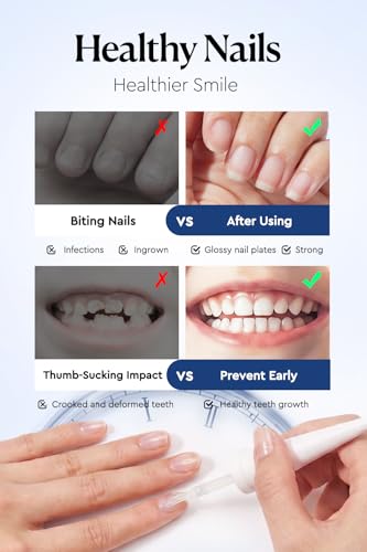 AZUREBEAUTY Anti-Nail Biting Treatment & Thumb Sucking Deterrent - 18ml