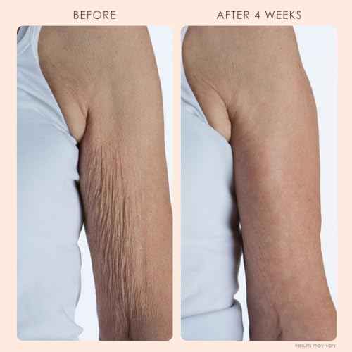 BODY FIRM Crepe Erase Body Repair Treatment, Anti-Aging Wrinkle Cream, Support Skins Natural Elastin & Collagen Production - 10oz