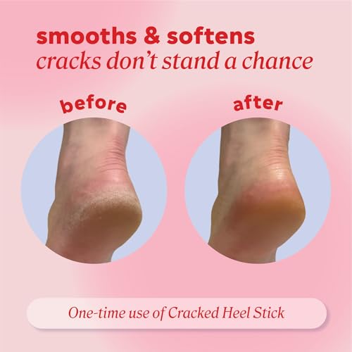 Onyx Professional Cracked Heel Repair Balm Stick, 2 Pack