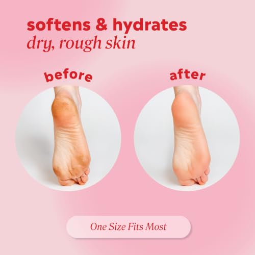 Onyx Professional Gel Moisturizing Socks for Dry Feet & Cracked Heel Repair