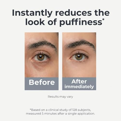 Caffeine & Retinol Eye Roller - Dark Circles & Puffiness Relief