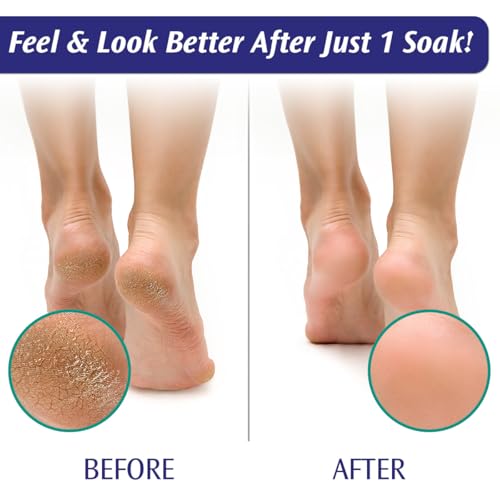 PediFix Tea Tree Oil & Epsom Salt Foot Soak Crystals (6 Packets)