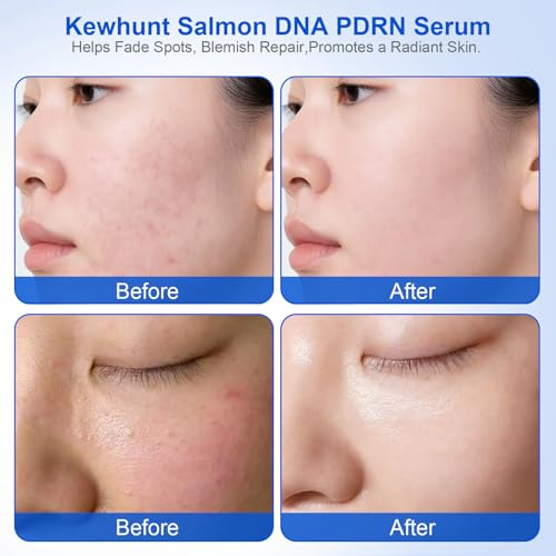 Salmon DNA PDRN Anti-Aging Facial Serum, 10,000ppm Salmon Egg DNA Ampoule, 3000ppm Collagen, Peptide, Glutathione, Niacinamide -Wrinkles, Firming, Radiance Skincare, 0.05 fl.oz x 30e