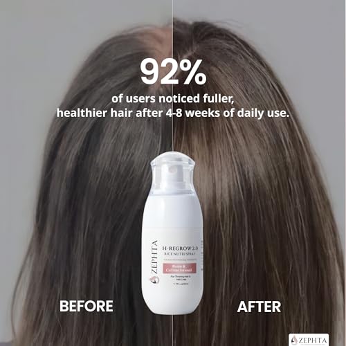 Zephta Hair Growth Spray with Biotin & Caffeine – Unisex Regrowth Serum for Thinning Hair