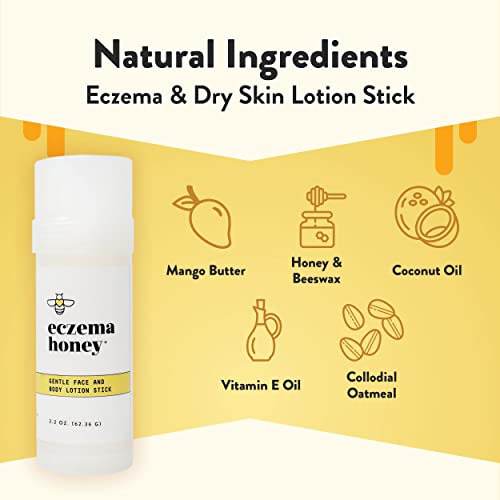 ECZEMA HONEY Premium Witch Hazel & Gentle Face and Body Lotion Stick - Natural Dry Skin Repair - For Senstive Skin