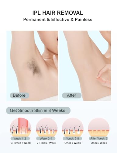 IPL Laser Hair Removal Device for Face Body & Legs - Painless Permanents with 999,999 Flashes