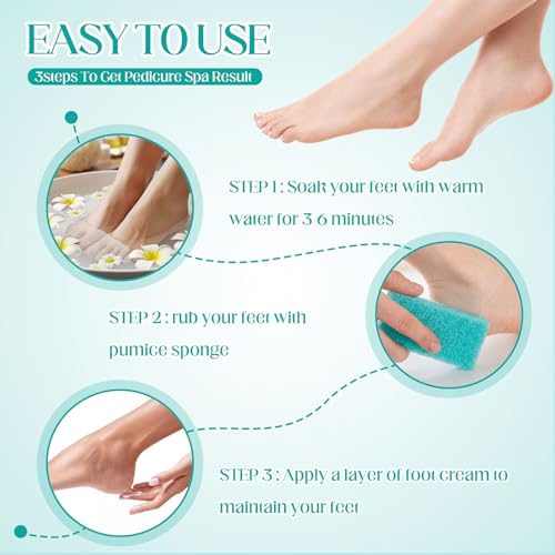 Pumice Stone Bulk 300 Pack - Foot Scrubber Callus Remover for Feet (Cyan)