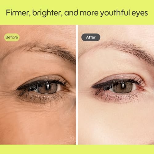 Kiero Pure Radiant Eye Cream - Lightweight & Fast-Absorbing Eye Crea for Puffiness, Bags Under Eyes & Dark Circles - Vegan, Firming Eye Moisturizer with Niacinamide & Centella Asiatica (0.85 fl oz)