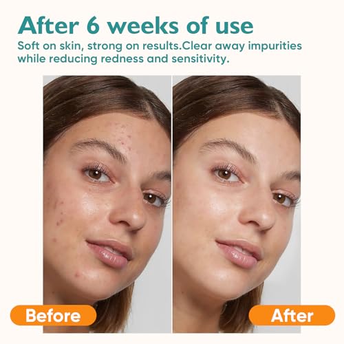 UNIMADE Disposable Face Towels - 8 Boxes, 400 Count, Soft & Gentle Facial Wipes