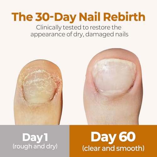 TuneTune Fermented Korean Cuticle Oil (8ml) - Hydrating Daily Nail Care