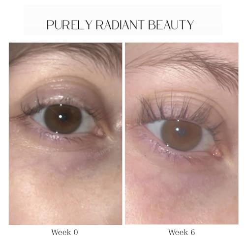 Lash Growth Serum – Prostaglandin-Free, Castor Oil Based