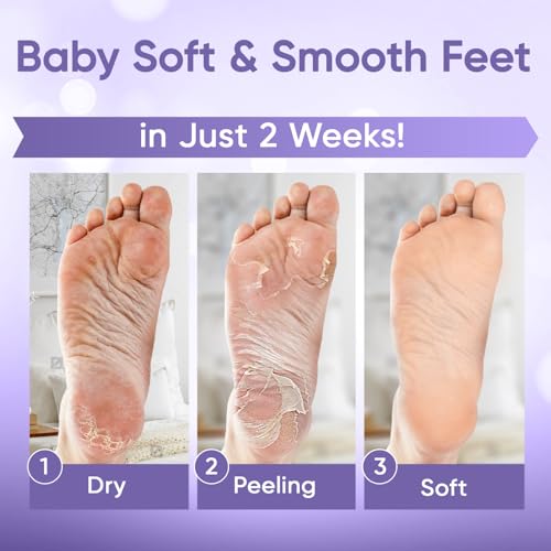 CÉLOR Foot Peeling Mask - Exfoliate Dry Cracked Feet (2 Pairs)
