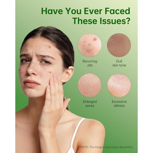 Azelaic Acid Cream for Face: Redness-Soothing Azelaic Acid Facial Cream for Uneven Tone, Blemish-Prone Skin, Pore Care and Skin Clarity Support, 1 oz