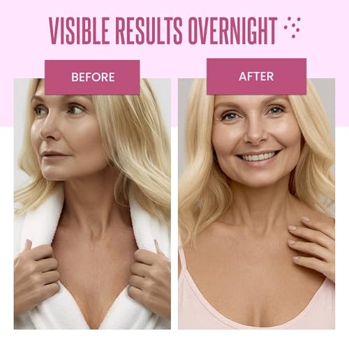 CLEVERFY Silicone Chest Wrinkle Patches – Reusable Anti-Wrinkle Pads