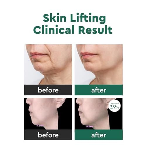 bewants Eye Serum Stick for Hydrating & Lifting Cream for Neck & D?collet? Wrinkle Care with 61% Bamboo Water & Cica, 1.01 fl.oz