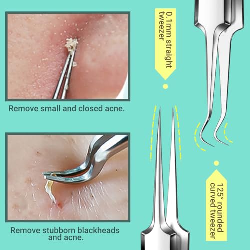 9pc Blackhead Remover & Ingrown Hair Tweezers Kit