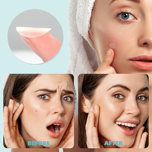 New Pimple Patches for Face, 3 Different Sizes Hydrocolloid Acne Patches,Large Pimple Patch Pimple Stickers for Covering Zits and Blemishes, Zit Patches Sticker for Face or Skin