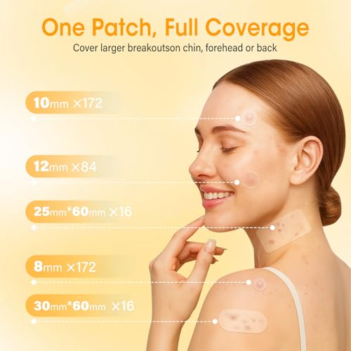 Pimple Patches for Face, 368 Counts 5 Sizes Large Patches, Hydrocolloid Blemishes Patch, Spot Dots Cover for Body, Chin, Cheek Zits & Blemish & Breakouts