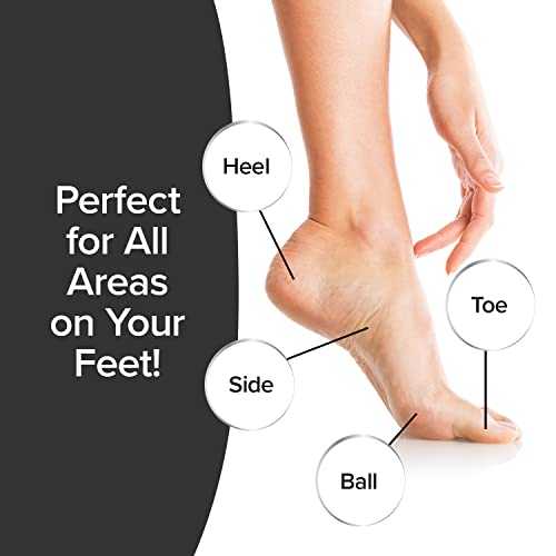 PedEgg Classic Foot File & Callus Remover - Mess-Free Exfoliating Tool