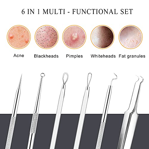 Blackhead Remover Tool Kit - 6 Pcs Pimple Popper with Stainless Steel Case