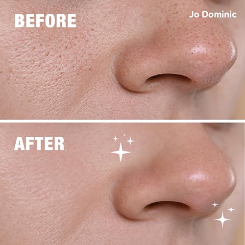 MAGIX PATCH 124 Pimple Patches by Jo Dominic?Large Pimple Patches for Face & Body, Big Acne Patches, Fits Various Areas XL Hydrocolloid Patch, Absorbs Oil & Zit Hydrocolloid Patch (7 Sizes)