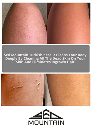 Sed Mountain - Exfoliating Glove - Body Scrub - Turkish Hammam Kese Mitt - Dead & Dry Skin Cleanser - Tan Remover Mitts - To Have a Soft Skin Care - For Women & Men (SED-1030 1 Units)