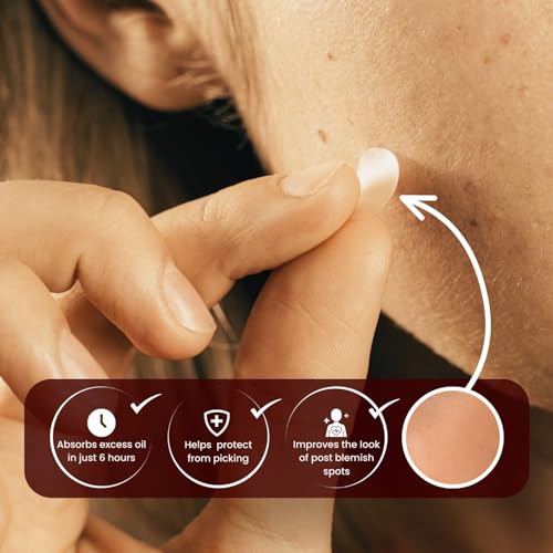Original Acne Patch, Hydrocolloid Technology, Dermatologist Tested, Drug-Free Blemish Treatment, 72 Count