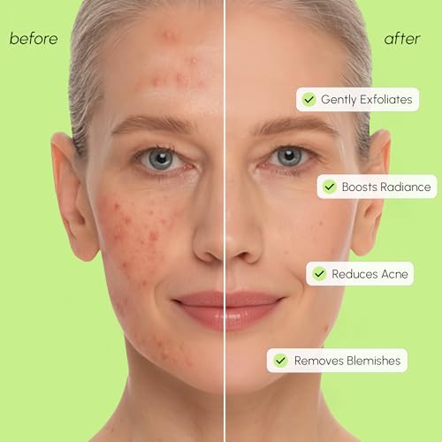 MAREE Salicylic Acid Exfoliating Toner - AHA BHA Face Exfoliant