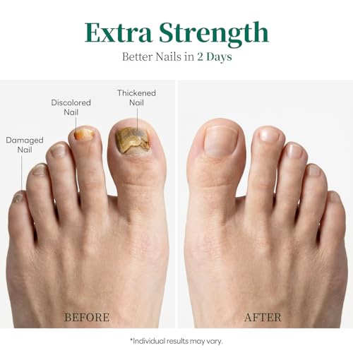 Apuree Extra Strength Antifungal Nail Pen | 6 Pcs Day & Night Treatment