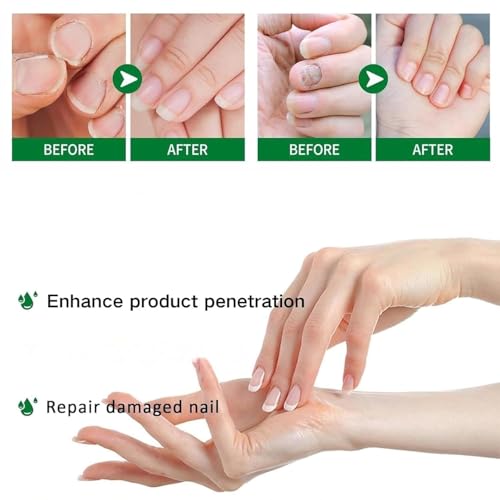 Ginger Nail Growth Serum - Strengthening Nail Repair Oil