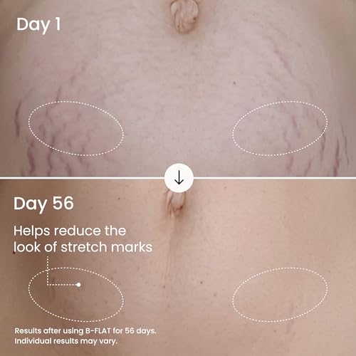 MA?LYS B-FLAT Belly Firming Cream for Women - Skin Tightening & Moisturizing Treatment with Shea Butter & Bentonite Clay - Smooths Look of Stretch Marks - Postpartum Body Care (3.4 Fl Oz)