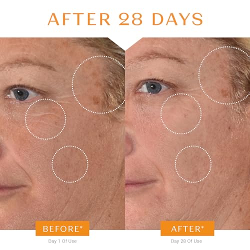 Yon-Ka 20% Vitamin C Serum | Highly Concentrated Anti-Aging Face Treatment to Even Tone, Firm Skin Texture and Boost Collagen | Made with 99% Narural Ingredients