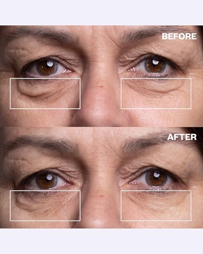 Wrinkles Schminkles Under Eye Patches - Medical Grade Silicone (3 Pairs)