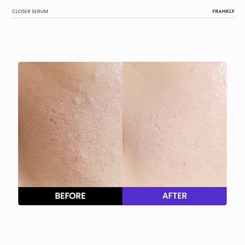 FRANKLY Dark Spot, Wrinkle & Pore Care Set ? Niacinamide Serum + Retinol Night Cream + Peptide Pore Serum | Complete Korean Routine | Skincare Gifts for Women