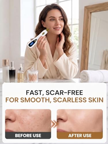Plasma Skin Tag Remover Pen with 9 Speed Levels, USB Rechargeable