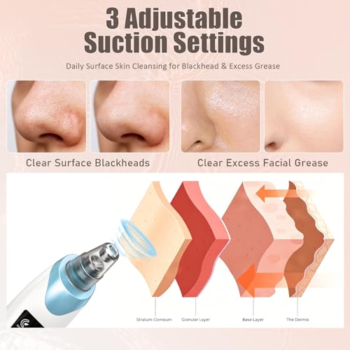 Gackoko Blackhead Remover Vacuum Kit - USB Rechargeable Pore Cleaner