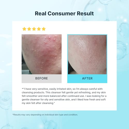 Tea Tree Facial Cleanser Foam for Oily & Sensitive Skin - 150ml