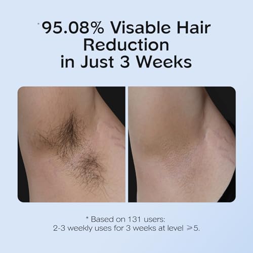 INNZA IPL Hair Removal Device with Ice Cooling, 999,999 Flashes