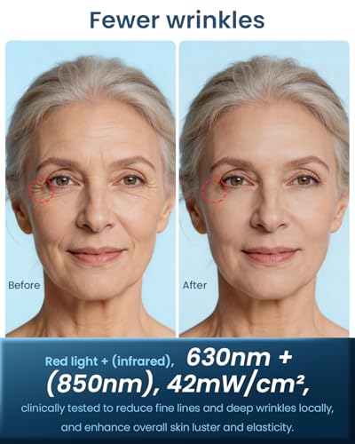 Jorking FDA-Cleared Red Light Therapy Mask for Face Anti-Aging