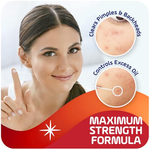 Asepxia 2% Salicylic Acid Acne Spot Treatment Cream, 1 Oz
