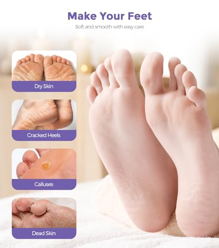 Lavender Foot Peel Mask Exfoliator for Dry, Cracked, Rough Heels - Natural Foot Care